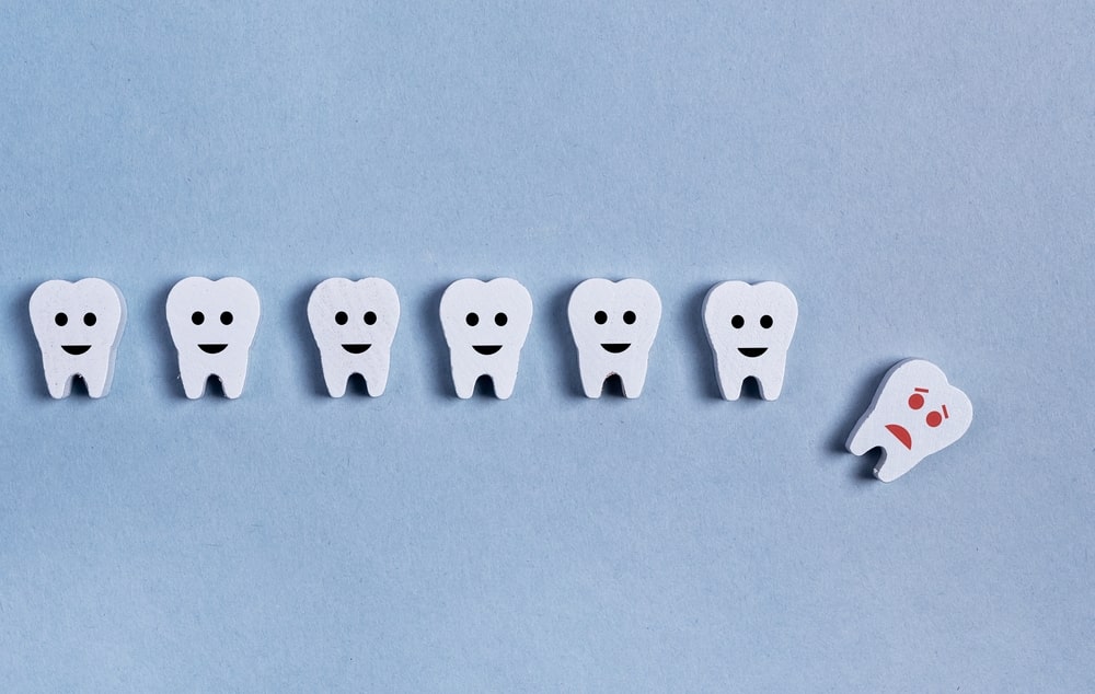 Une avulsion dentaire est une dent qui est perdue après un choc