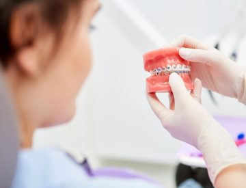 Bris d’appareil orthodontique : nos conseils pour bien réagir
