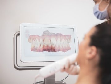 Le scan iTero pour des empreintes dentaires numériques