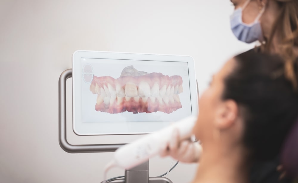 Le scan iTero pour prendre des empreintes numériques des dents