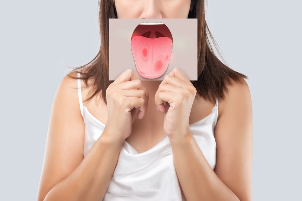 Les plaques rougeâtres sur le langue sont un symptôme du cancer de la bouche
