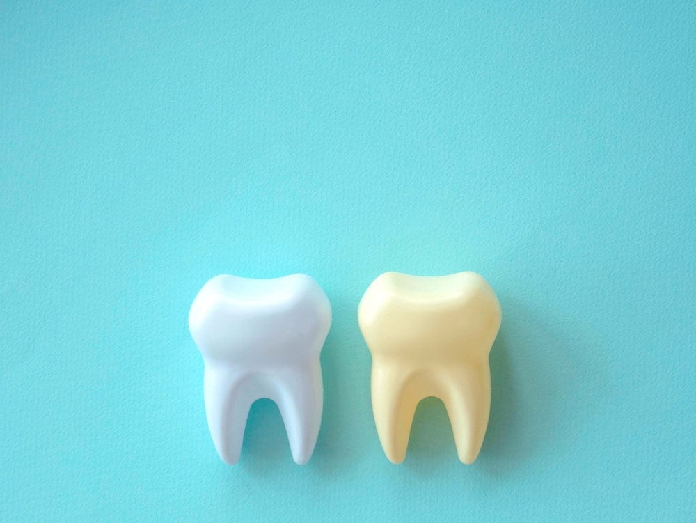 Un concept de dents jaunes et de dents blanches
