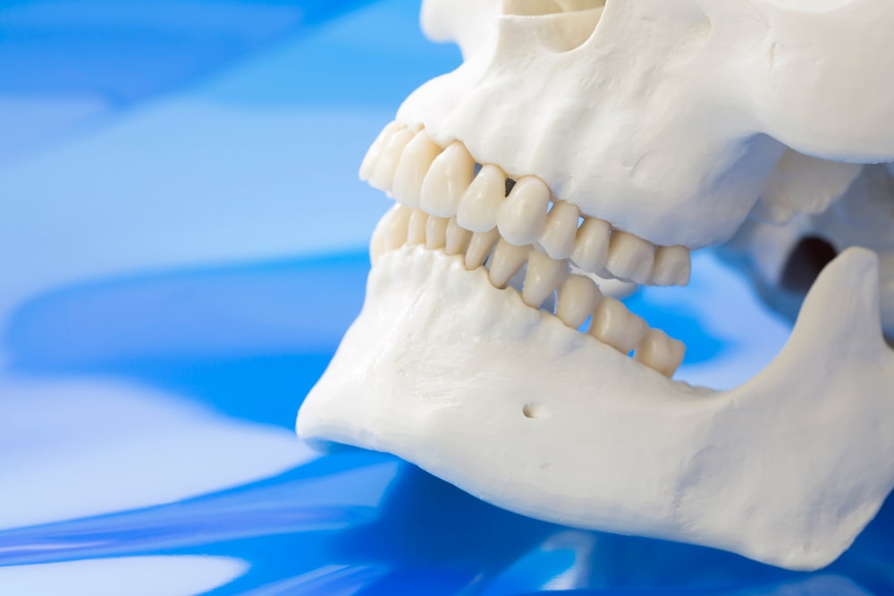 Modele de mâchoire avec une malocclusion à traiter ne orthodontie