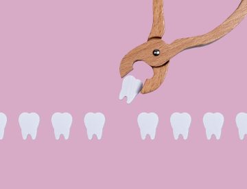 Alvéolite après une extraction : comprendre, prévenir et traiter cette complication