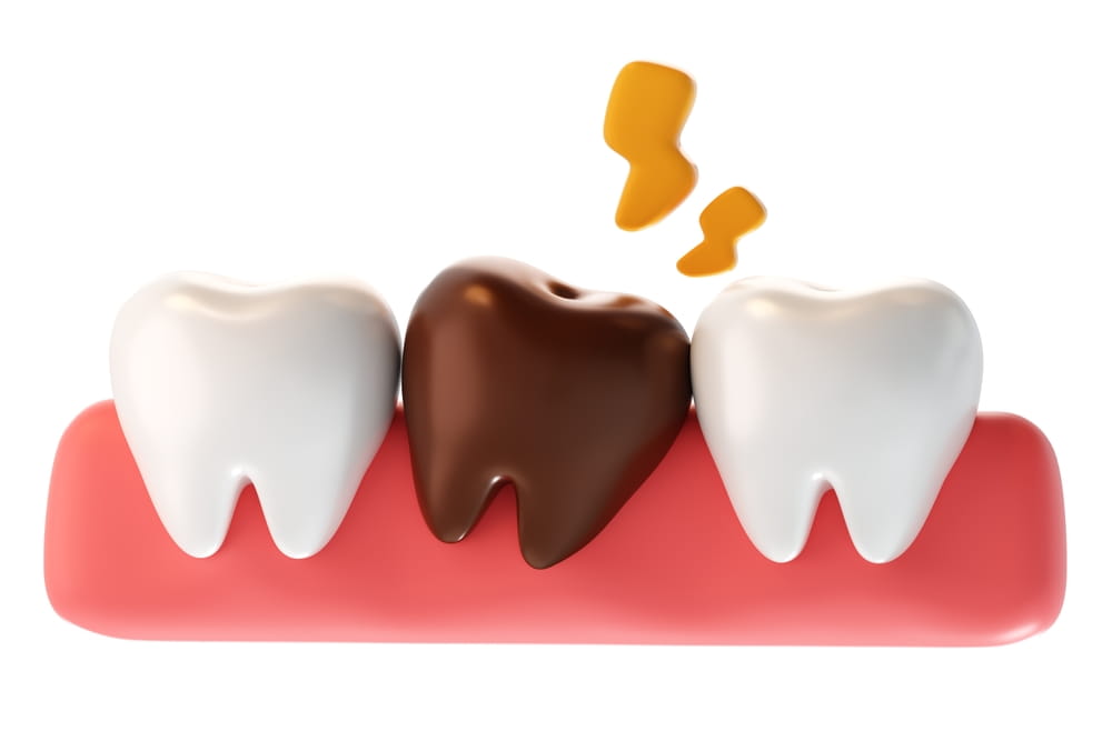 Illustration 3D avec une dent qui noircit